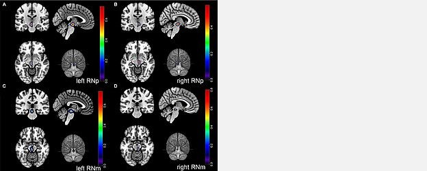 Hhu Brain Scans